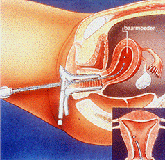 embryo